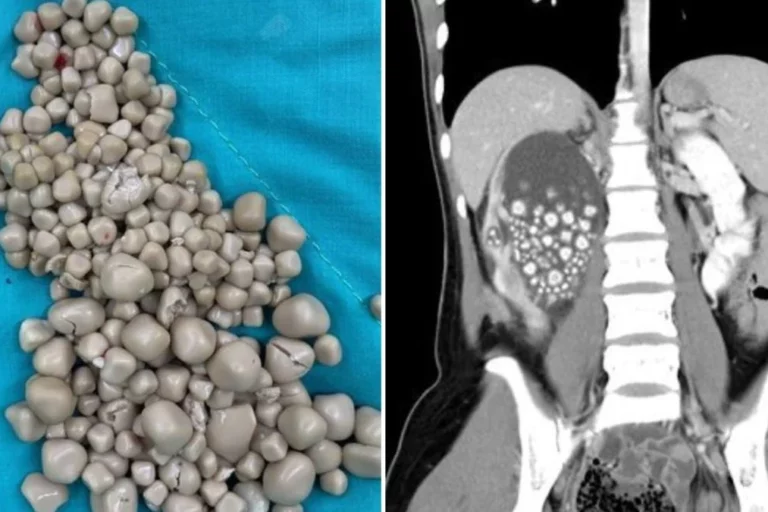 MSN-Featured-18-1200×675