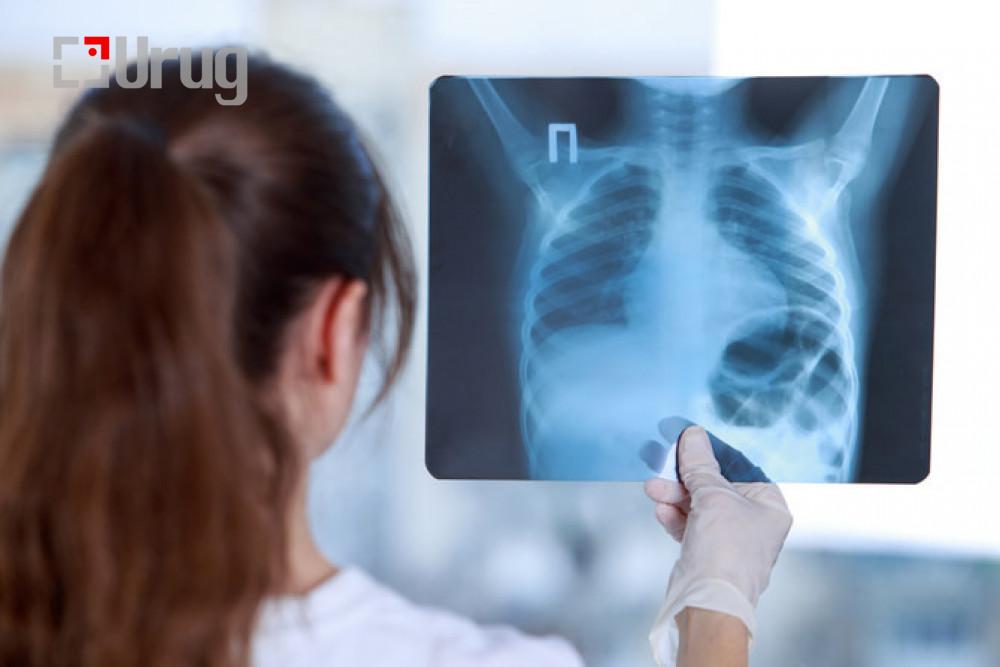 -20012021-1611125869-1801635669-2368956-981071737