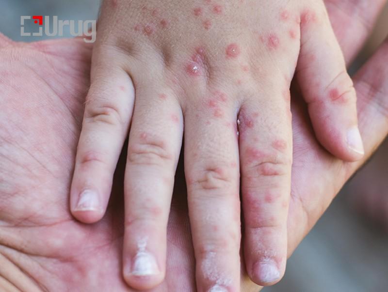 b84416b95fc4a22fe60a37d8dac4cc09_x3