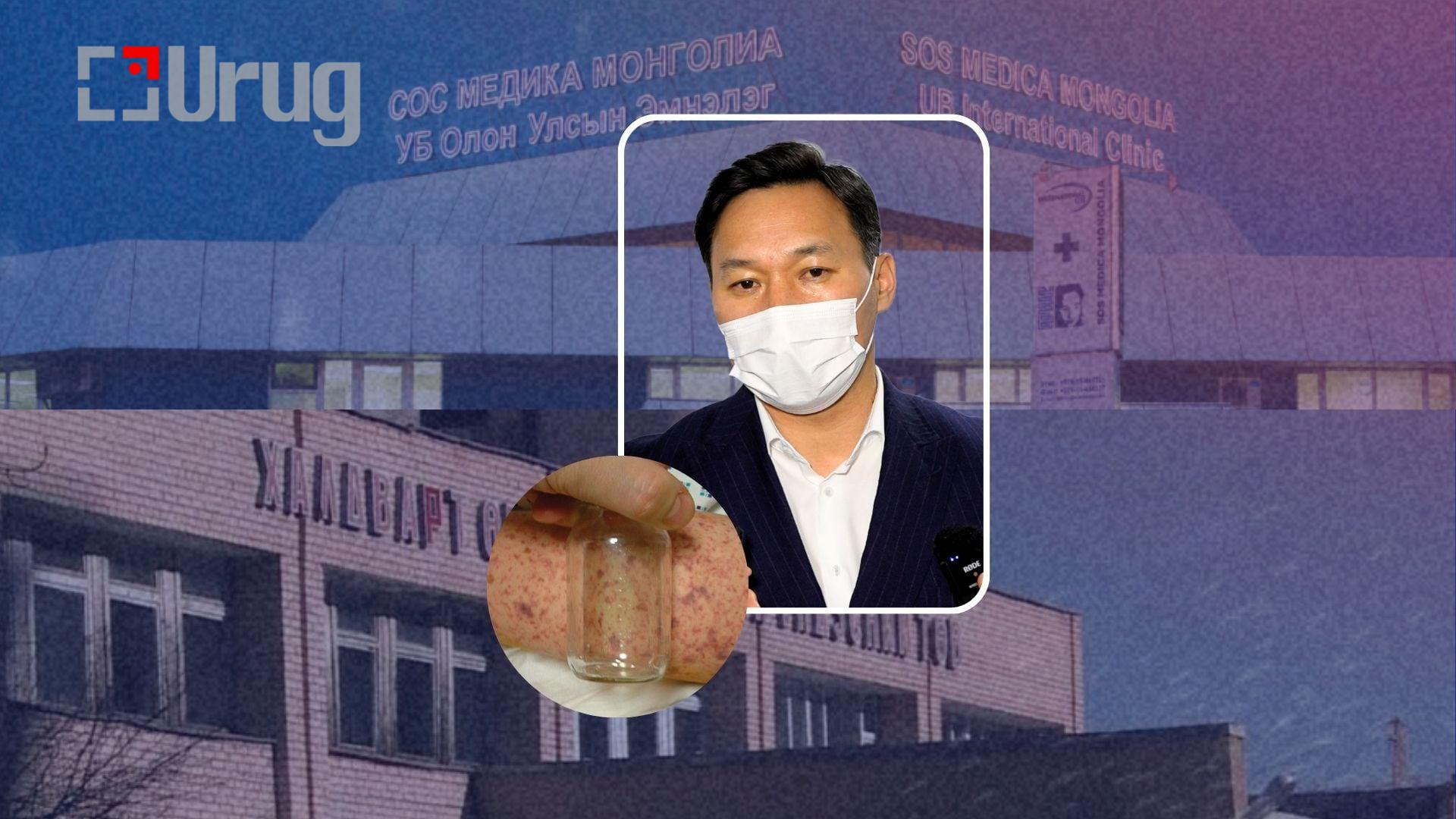 meningit monhsaikhan