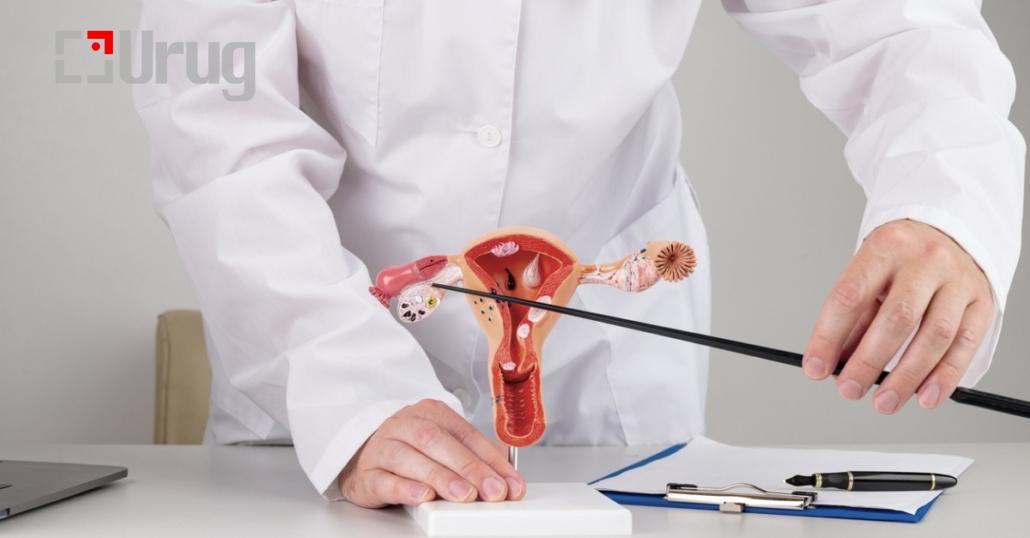 doctor-gynecologist-pointing-model-of-female-reproductive-system-on-his-desktop-1030×538