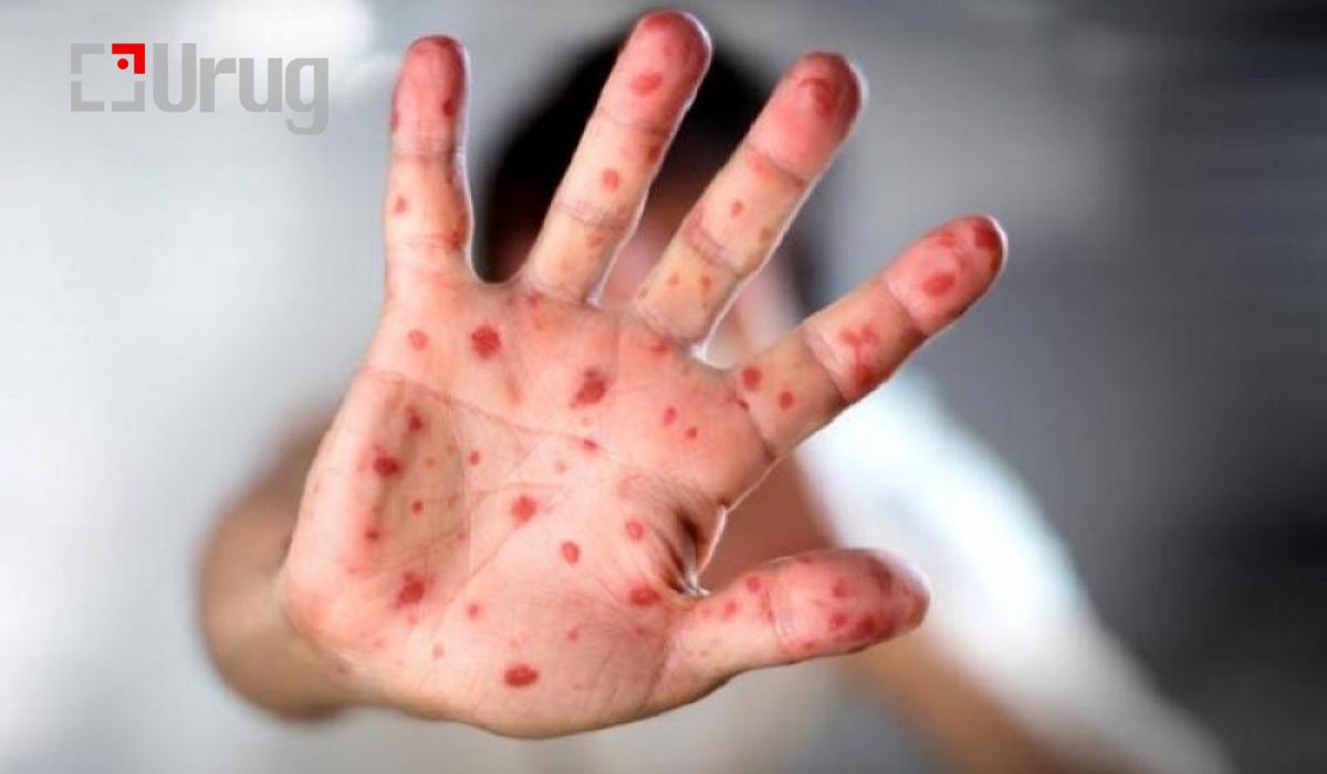 55ea9055-1dc0-472c-b627-a059be0631d2-d96a8dba96d22412c03cf2f30171fa4da682cced